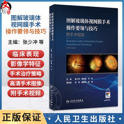 图解玻璃体视网膜手术操作要领与技巧 附手术视频 张少冲 张钊填 方冬 主编 参考书 眼科学 西医 9787117403016 人民卫生出版社
