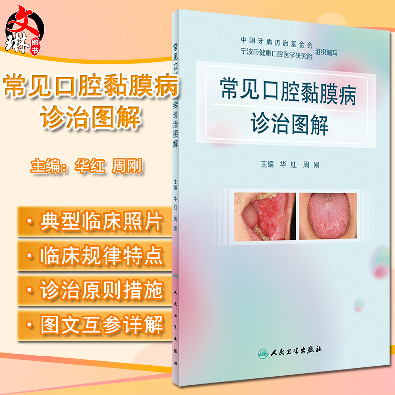 常见口腔黏膜病诊治图解 华红 周刚 口腔科学书籍 局部湿敷激光治疗 免疫调节药含漱剂涂剂用药 人民卫生出版社9787117317337