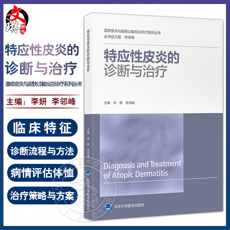特应性皮炎的诊断与治疗