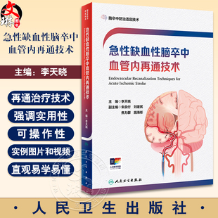 人民卫生出版 急性缺血性脑卒中血管内再通技术 AlS血管内再通技术流程建设技术操作培训术后康复等 李天晓 社9787117362047 附视频