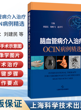 脑血管病介入治疗：OCIN病例精选 刘建民 杨鹏飞 赵开军 适用神经外科和神经内科及相关专业的临床医师、师生 上海科学技术出版社