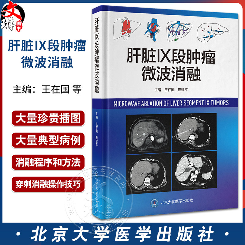 肝脏肝脏Ⅸ段肿瘤微波消融