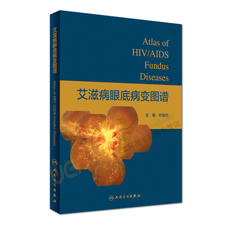 【包邮】正版 艾滋病眼底病变图谱  叶俊杰主编 人民卫生出版社 9787117244251