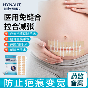 海氏海诺减张器减张贴医用剖腹产术后皮肤疤痕儿童免缝合伤口贴