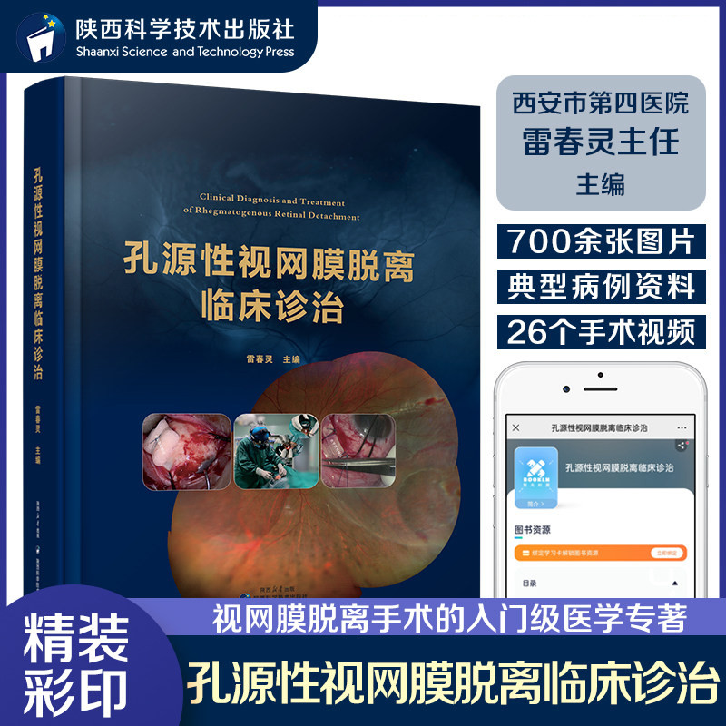 孔源性视网膜脱离临床诊治