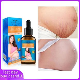 essential 补水提拉 Pregnancy marks wrinkle Stretch scar oil