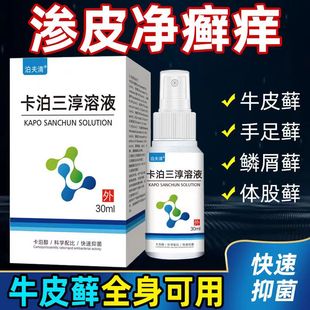 卡泊三淳喷雾剂30ml牛皮癣银屑病卡泊三醇倍他米松软膏正品擦剂