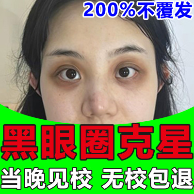 黑眼圈去除神器特别严重眼霜淡化细纹女士男士学生党眼袋消除暗沉