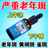 去老年斑精华液强力去除手部脸部黄褐斑雀斑黑色素斑点专用溶斑液