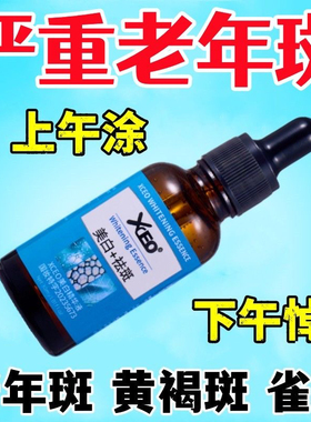 去老年斑精华液强力去除手部脸部黄褐斑雀斑黑色素斑点专用溶斑液