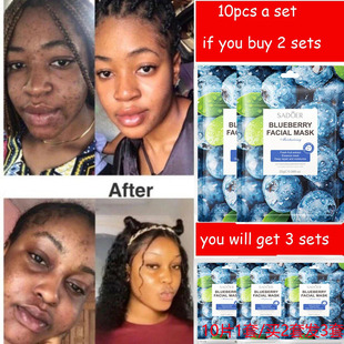 Facial Mask Whitening Blueberry Moisturizing Oil-Control面膜