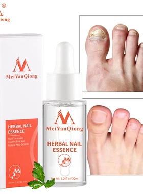 herbal Nail Treatment Essence oil Fungus Removal Repair护甲
