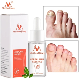 herbal Nail Treatment Essence oil Fungus Removal Repair护甲