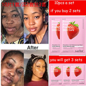 spot Strawberry remove面膜补水 mask acne Moisturizing facial