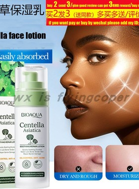 Centella Asiatica Face lotion Anti Acne smoothing积雪草乳液