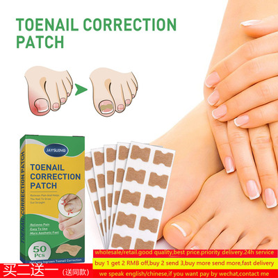 NailCorrectionStickerIngrow