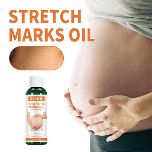 Oil Slack Remover Stretch Essential Maternity Marks Pregnant