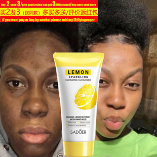 lemon facial cleanser black skin wash cream acne spot洗面奶