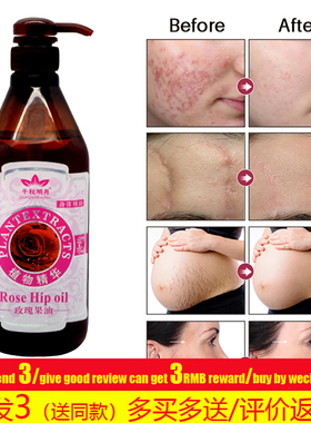 Natural Organic RoseHip Oil Massage Face body玫瑰果按摩精油