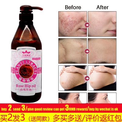 OrganicRoseHipOil玫瑰果精油