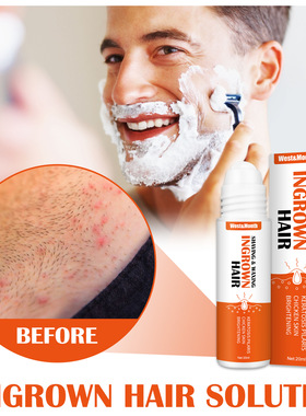 Razor Bumps Removal Solution Ingrowns Hair treatment shave液