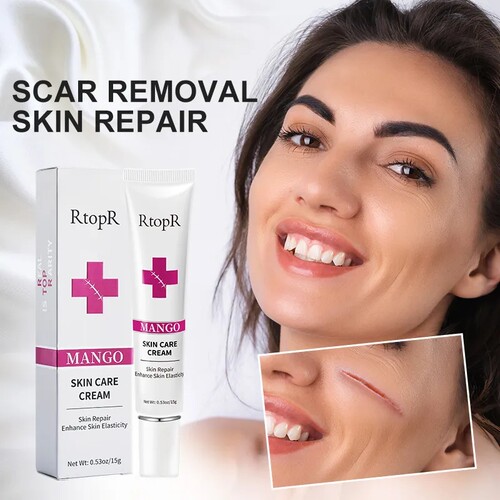 scarRemovalCream去疤痕霜面霜