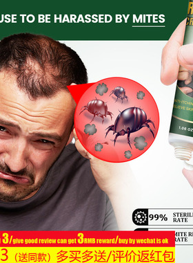 hair Mite Removal Cream Anti Itching Ointment Prevent头发膏