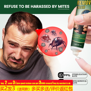 hair Mite Removal Cream Anti Itching Ointment Prevent头发膏