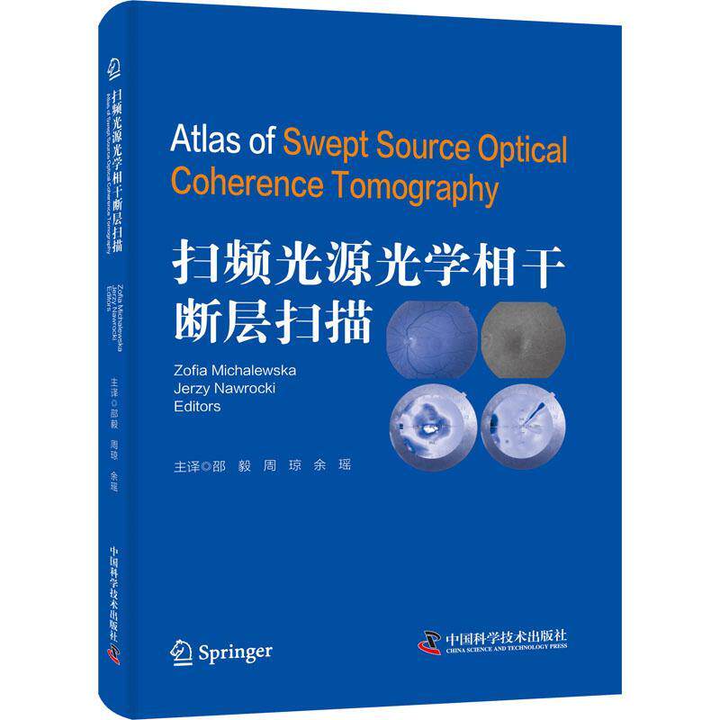 扫频光源光学相干断层扫描书索菲亚·麦克沃斯卡眼病影象诊断普通大众