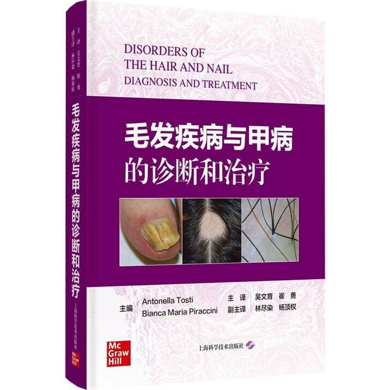 毛发疾病与甲病的诊断和治疗 毛发与甲病的临床类型 脱发疾病毛发移植甲病甲外科诊疗工作的皮肤科皮肤外科整形外科医学美容科