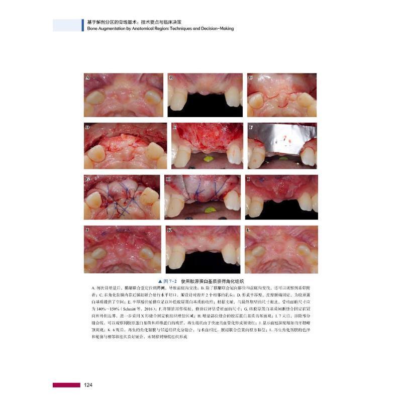正版基于解剖分区的骨增量术:技术要点与临床决策:techniques and decision-m书店医药卫生中国科学技术出版社书籍 读乐尔畅销书