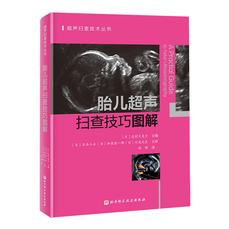 胎儿超声扫查技巧图解 超声扫查技术丛书 一本书彻底搞懂胎儿心超扫查切面正常胎儿神经系统发育超声解剖图谱书籍