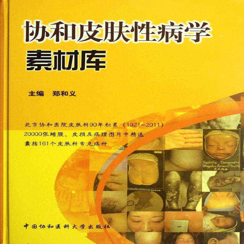 协和皮肤学素材库 郑和义 皮肤病图谱 医药卫生书籍中国协和医科大学出版社