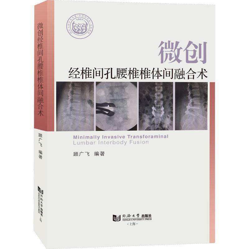 孔腰椎椎体间融合术的适应证中骨科医师提供参考同济大学出版社书籍
