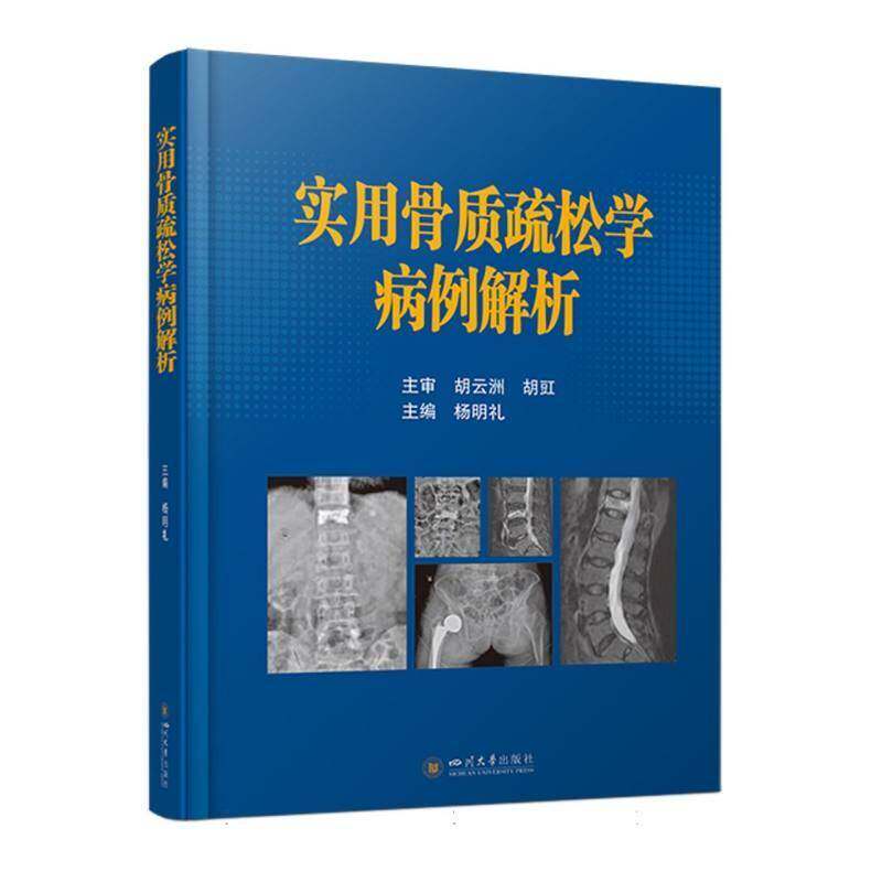 实用骨质疏松学病例解析 杨明礼 骨折诊疗指南 老年骨科临床实践手册 9787569078923 四川大学出版社