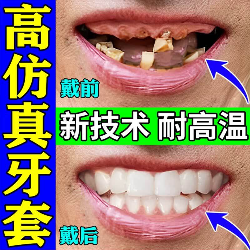 牙套通用吃饭神器成人假牙套仿真牙齿万能老年人磨牙吃饭神器遮丑