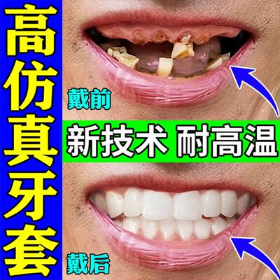 牙套通用吃饭神器成人假牙套仿真牙齿万能老年人磨牙吃饭神器遮丑