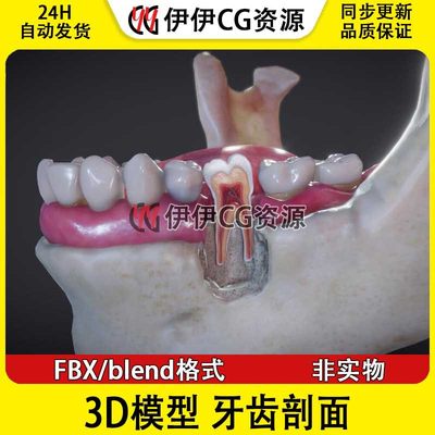 3D模型FBX医学结构解剖Tooth牙齿剖面牙龈口腔blend口腔牙神经