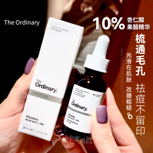 【保税】The Ordinary 10%杏仁酸果酸精华液30ml去角质去闭口粉刺