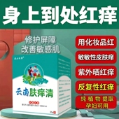 湿痒全身起包皮肤烧痒特效云南肤痒清各种皮肤痒通用蚊虫叮咬止痒