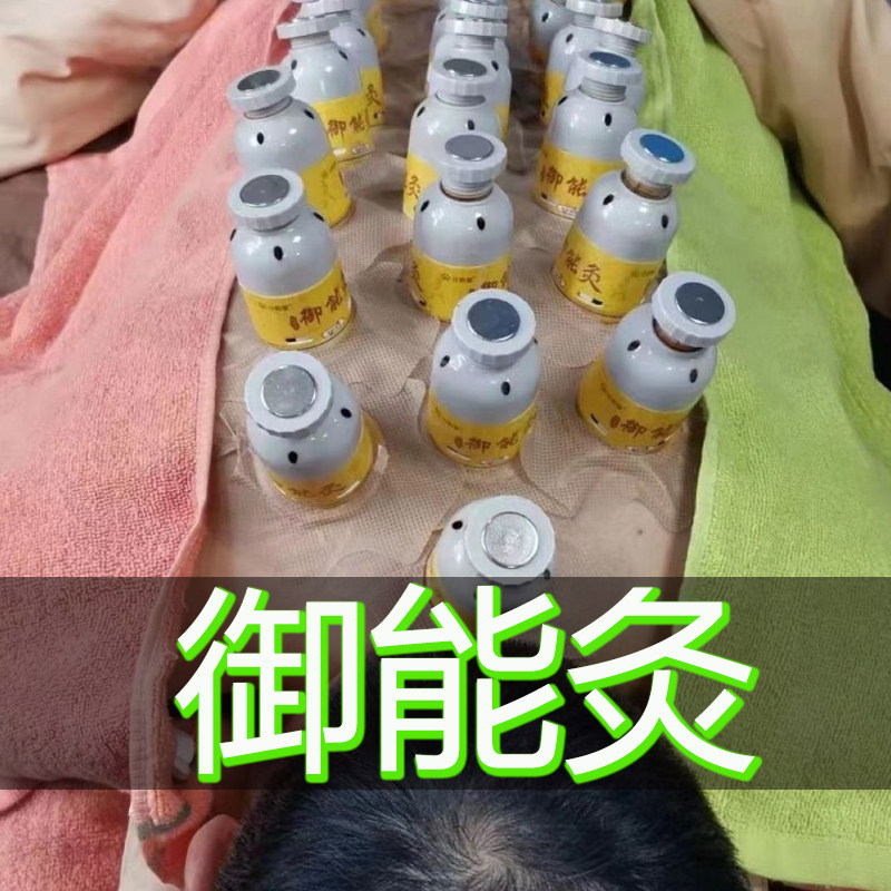 御能灸艾灸罐磁铁艾柱磁针悬灸益灸康元佑堂同款儿童贴穴位艾灸盒