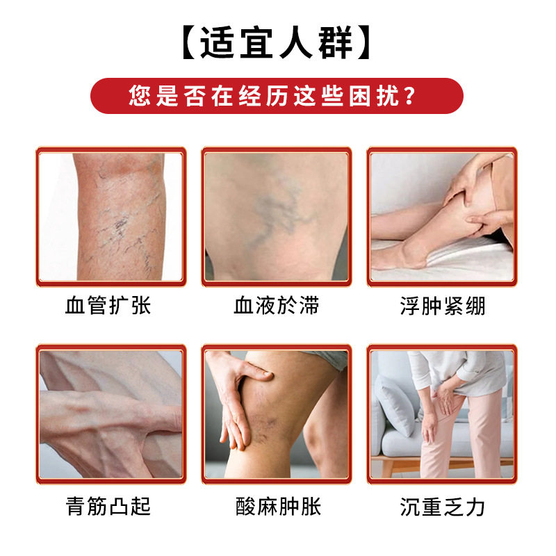 雪槐静脉舒膏舒缓蚯蚓腿青筋凸起腿酸麻胀疼痛曲张腿部护理静脉膏