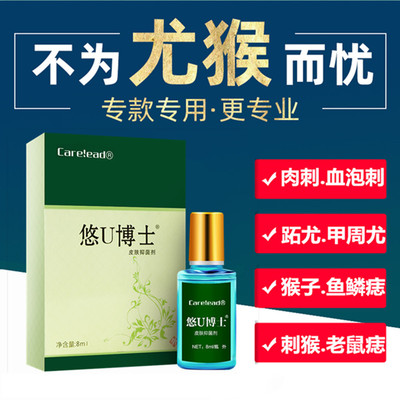 康纳悠U博士去除肉刺瘊子神器寻常丝状扁平鸡眼膏跖尤专用血泡刺