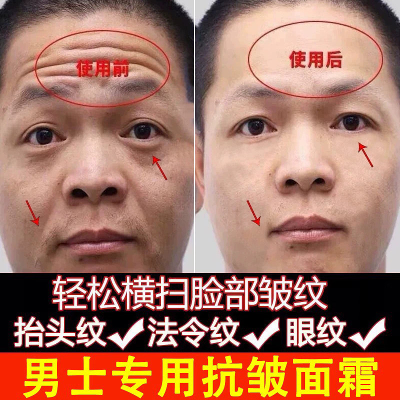 男士抗皱紧致面霜正品祛除皱纹神器抬头纹去除细纹法令纹