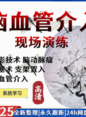 脑血管介入造影诊治视频颈动脉血管成形支架植入术动脉瘤栓塞影像