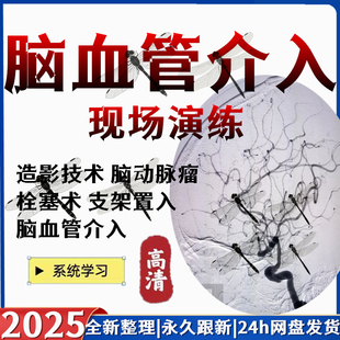 脑血管介入造影诊治视频颈动脉血管成形支架植入术动脉瘤栓塞影像