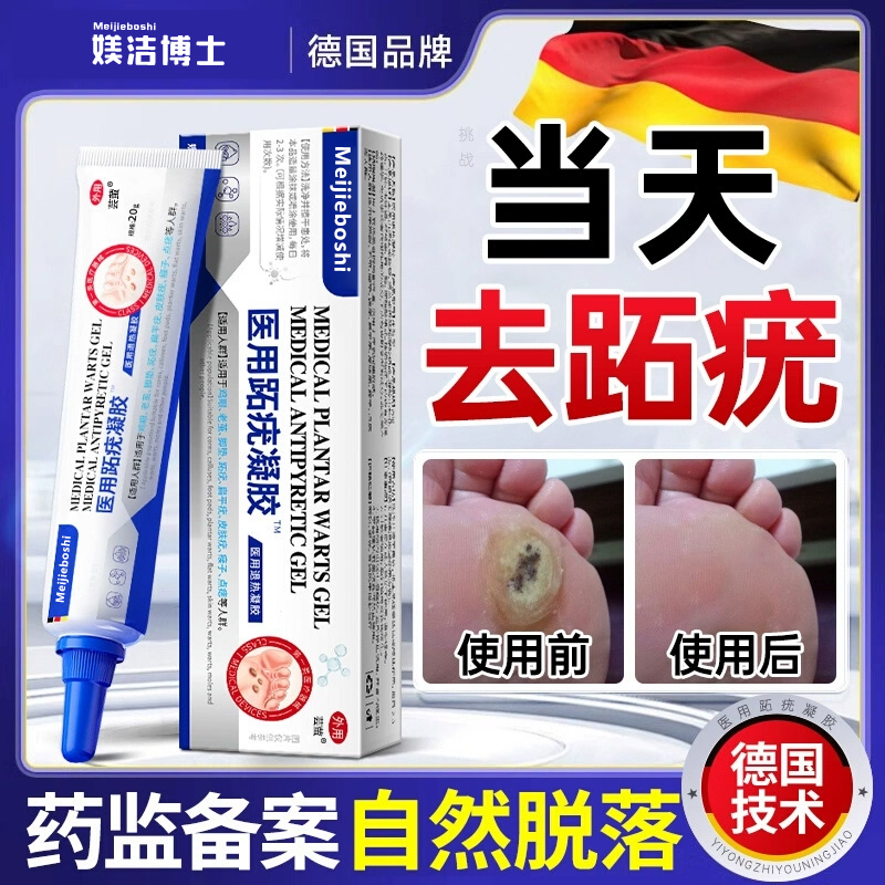 跖疣专用膏去足部脚底趾疣根病疣毒连拔除脚钉祛除膏鸡茧眼药房bt