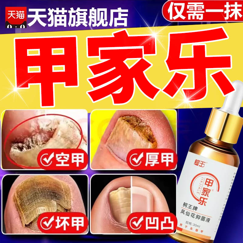 甲家乐凤仙花护理液官方旗舰店正品鳄王牌甲家乐抑菌液1er