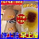 艾灸祛湿贴去湿气湿寒排毒大肚子肥肚脐除减燃脂官三伏贴正品 瘦ep