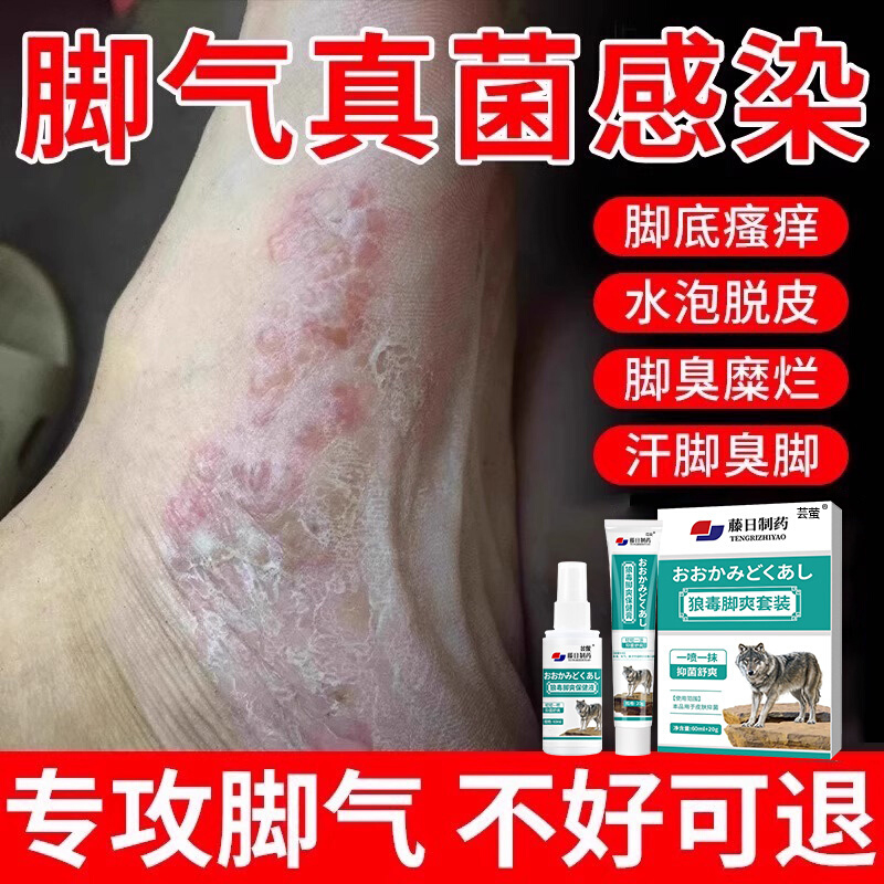 【药房严选】七天和脚痒说拜拜